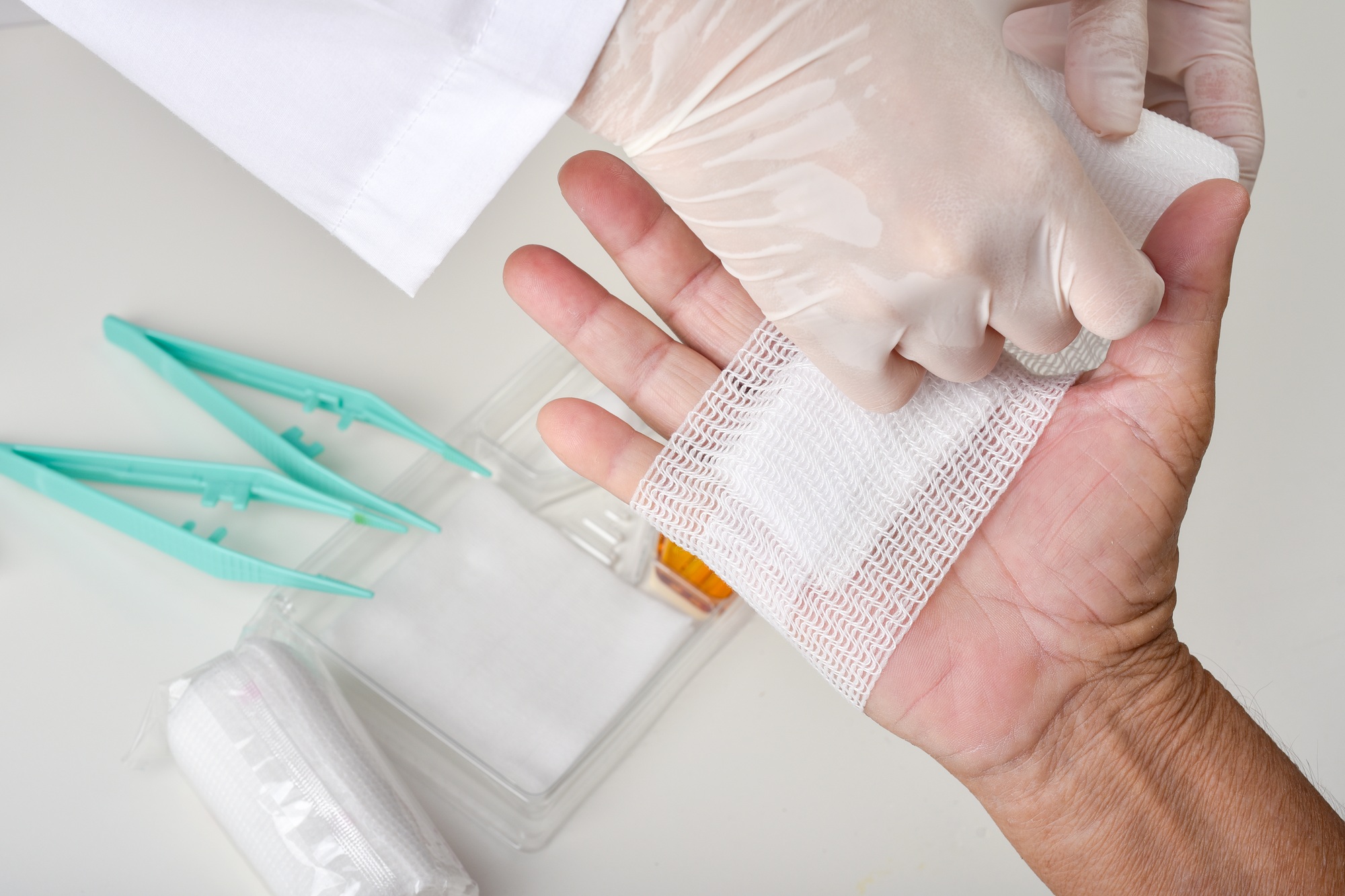 Doctor doing wound dressing care and bandaging patient's hand, Hand surgery treatment